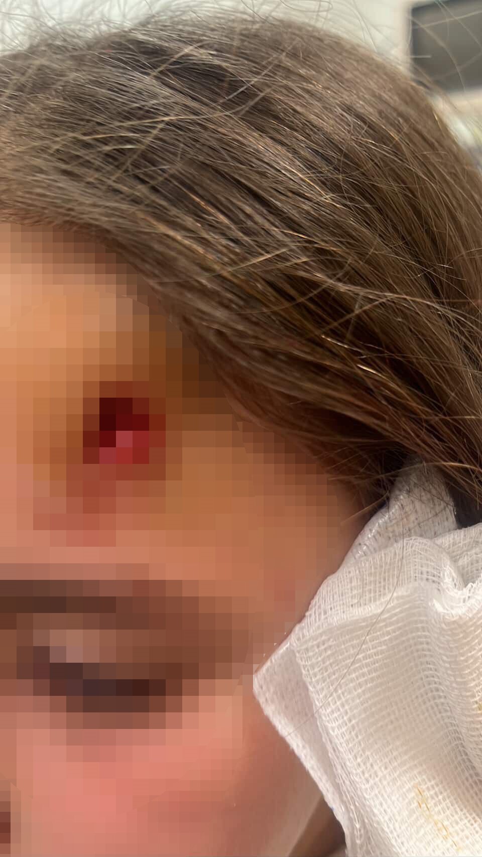 Okul Çıkışında Dehşet Ters Yönden Gelen Scooter Anne Ve Çocuğu Biçti (2)