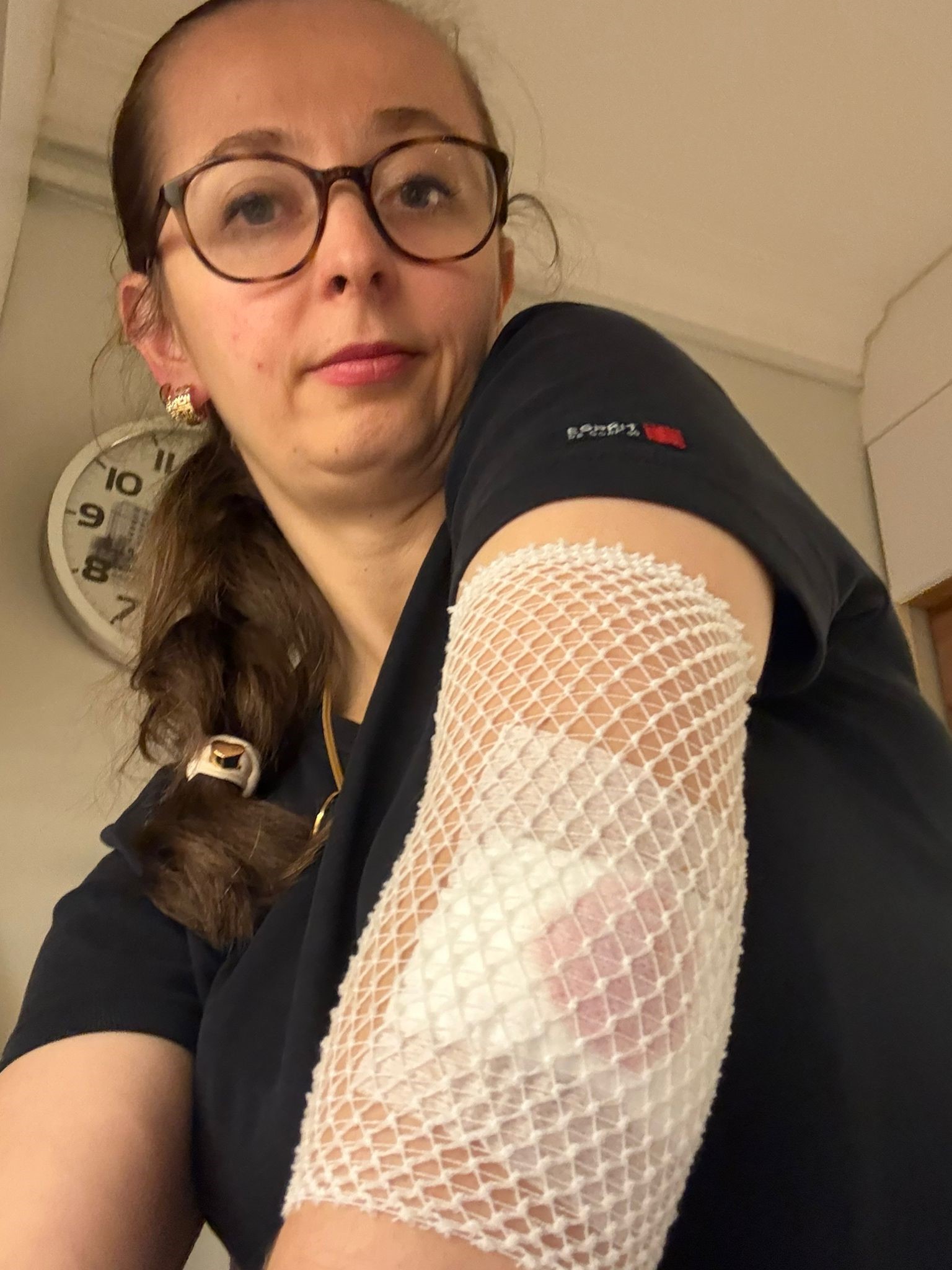 Okul Çıkışında Dehşet Ters Yönden Gelen Scooter Anne Ve Çocuğu Biçti (3)