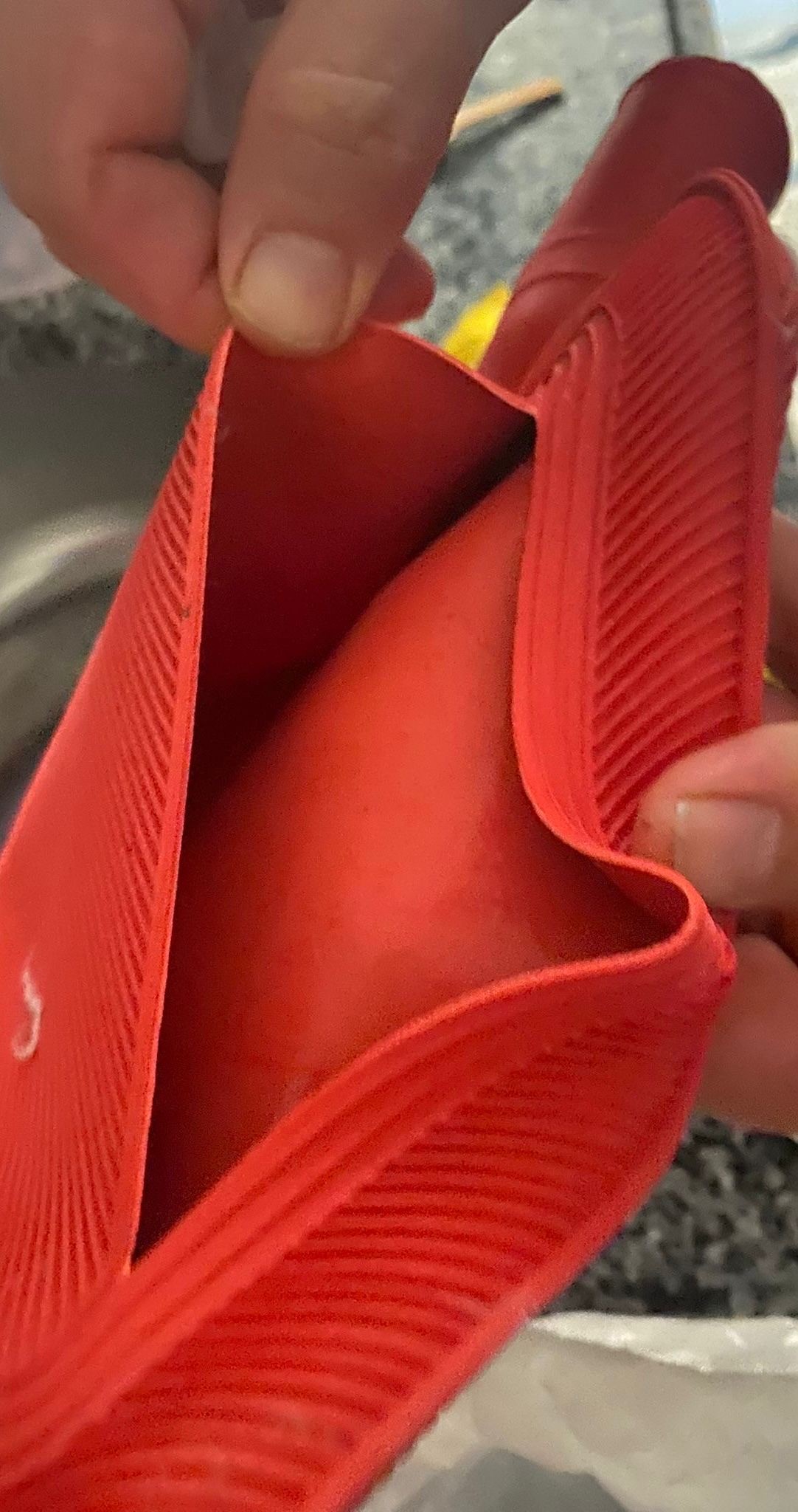 Rahatlamak Isterken Hayatının Şokunu Yaşadı! Sıcak Su Torbası Patladı, Genç Kadın Ölümden Döndü (4)