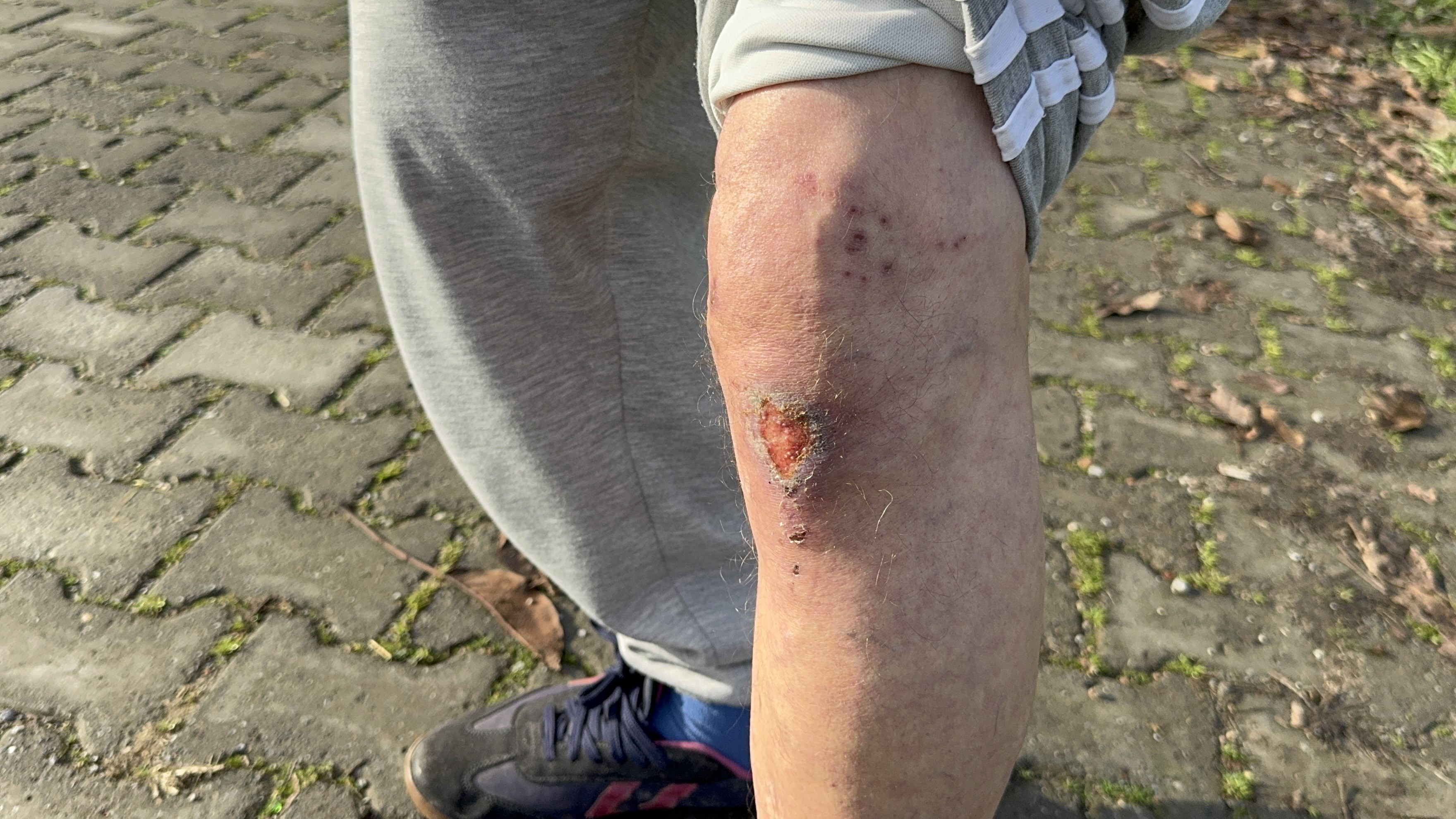 Yaşlı Adamı Sürükleyip 8 Milyonluk Altınını Çaldılar Dehşet Anları Kamerada (8)