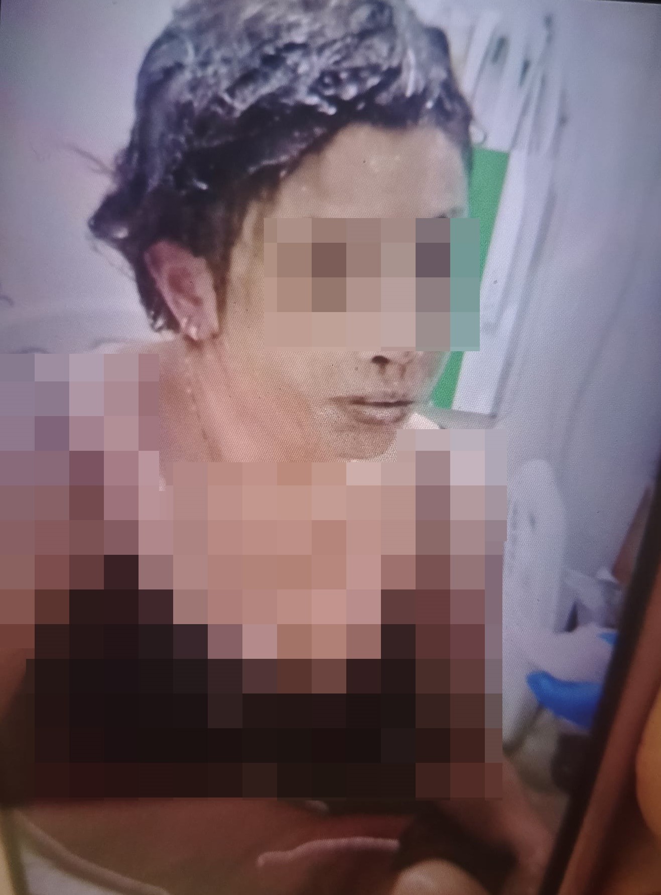 Bayilana Kadar Doktu Demisti Kezzapli Saldirida Yeni Goruntuler (4)