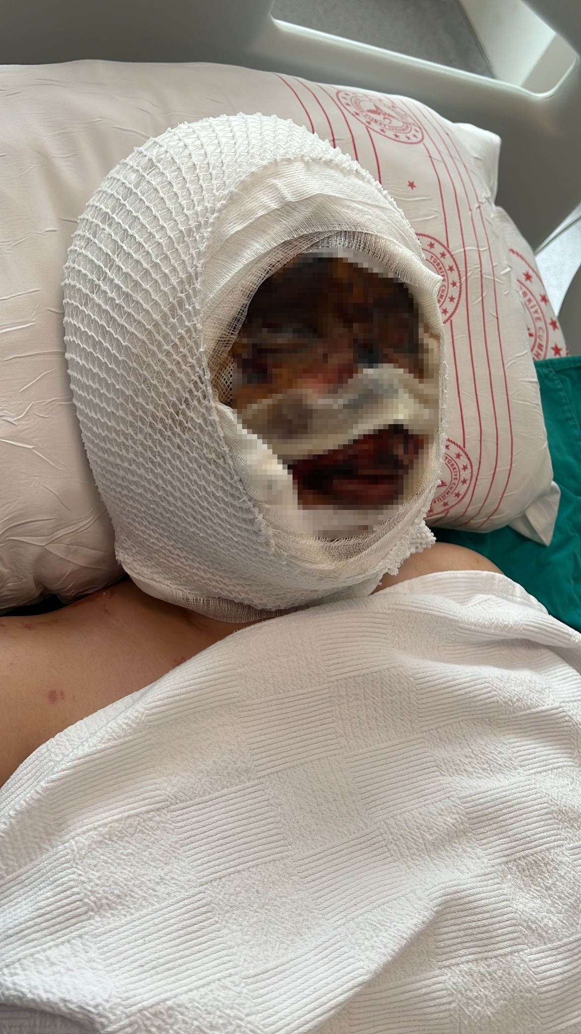 Bayilana Kadar Doktu Demisti Kezzapli Saldirida Yeni Goruntuler (8)