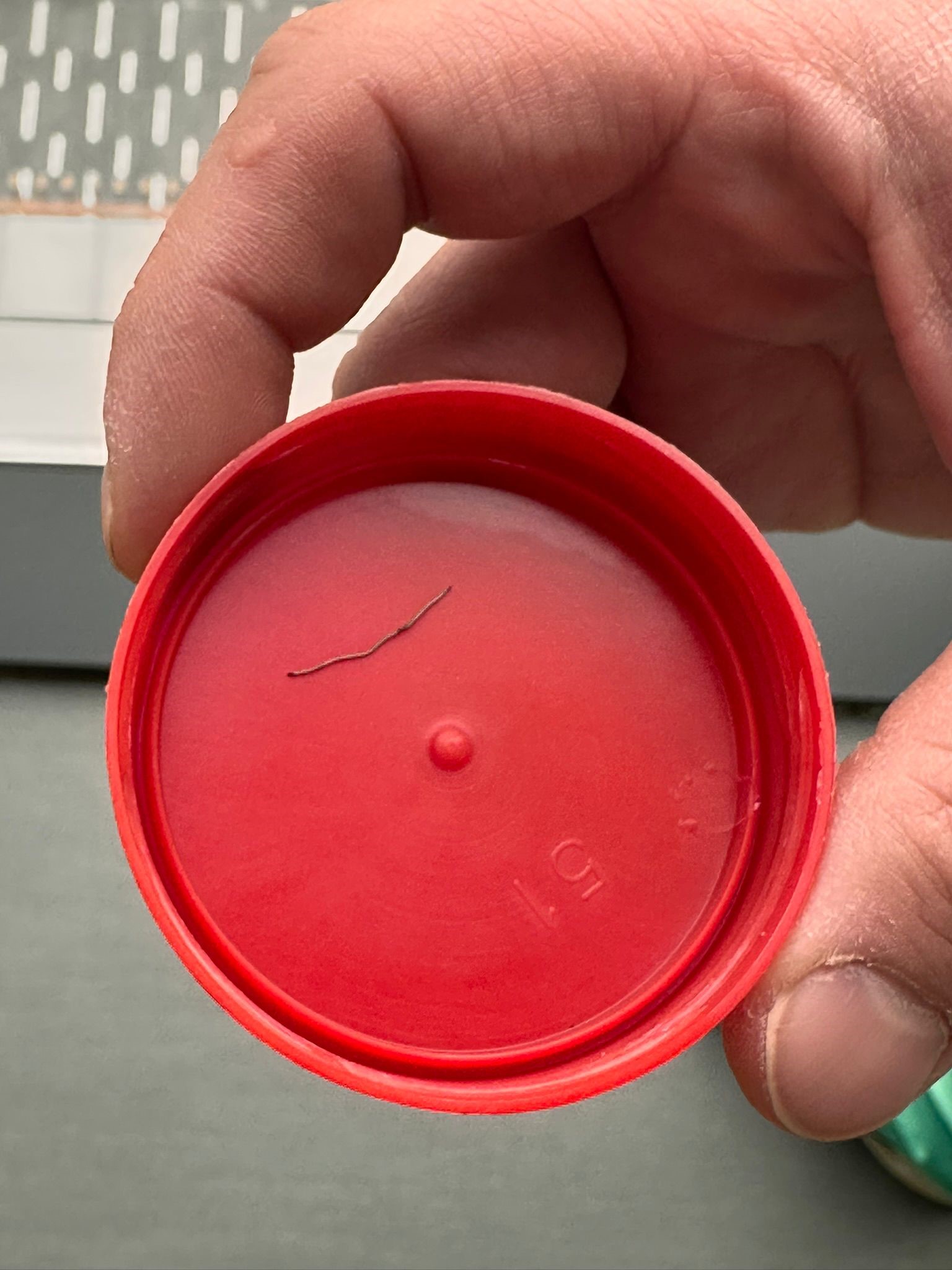 Bebeğin Huzursuzluğunun Nedeni Şoke Etti Akciğere Ilerleyen Zımba Teli (2)