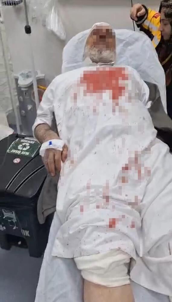 Cami Yolunda Dehset 72 Yasindaki Adam Sopalarla Darp Edildi (2)