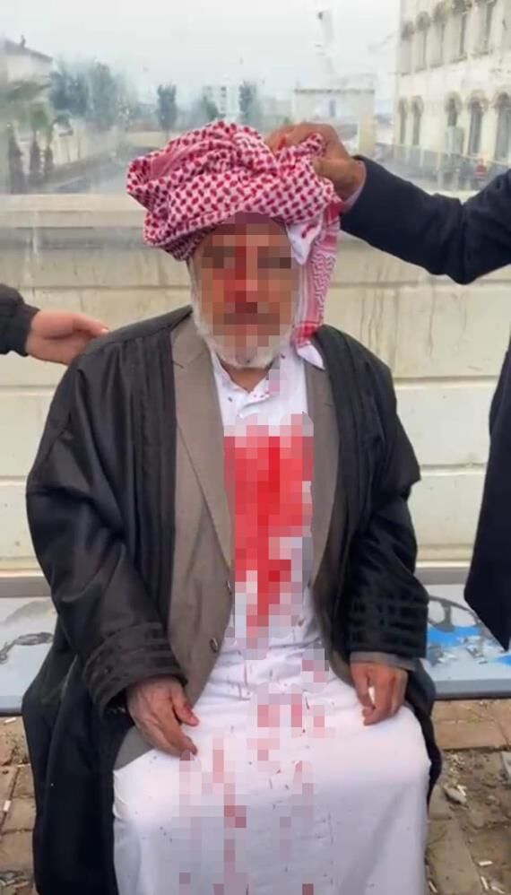 Cami Yolunda Dehset 72 Yasindaki Adam Sopalarla Darp Edildi (3)