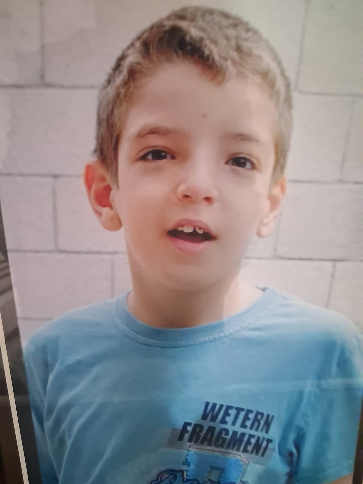 Depremde Anne Babasını Kaybeden Siyam Ikizlerinden Acı Haber (2)