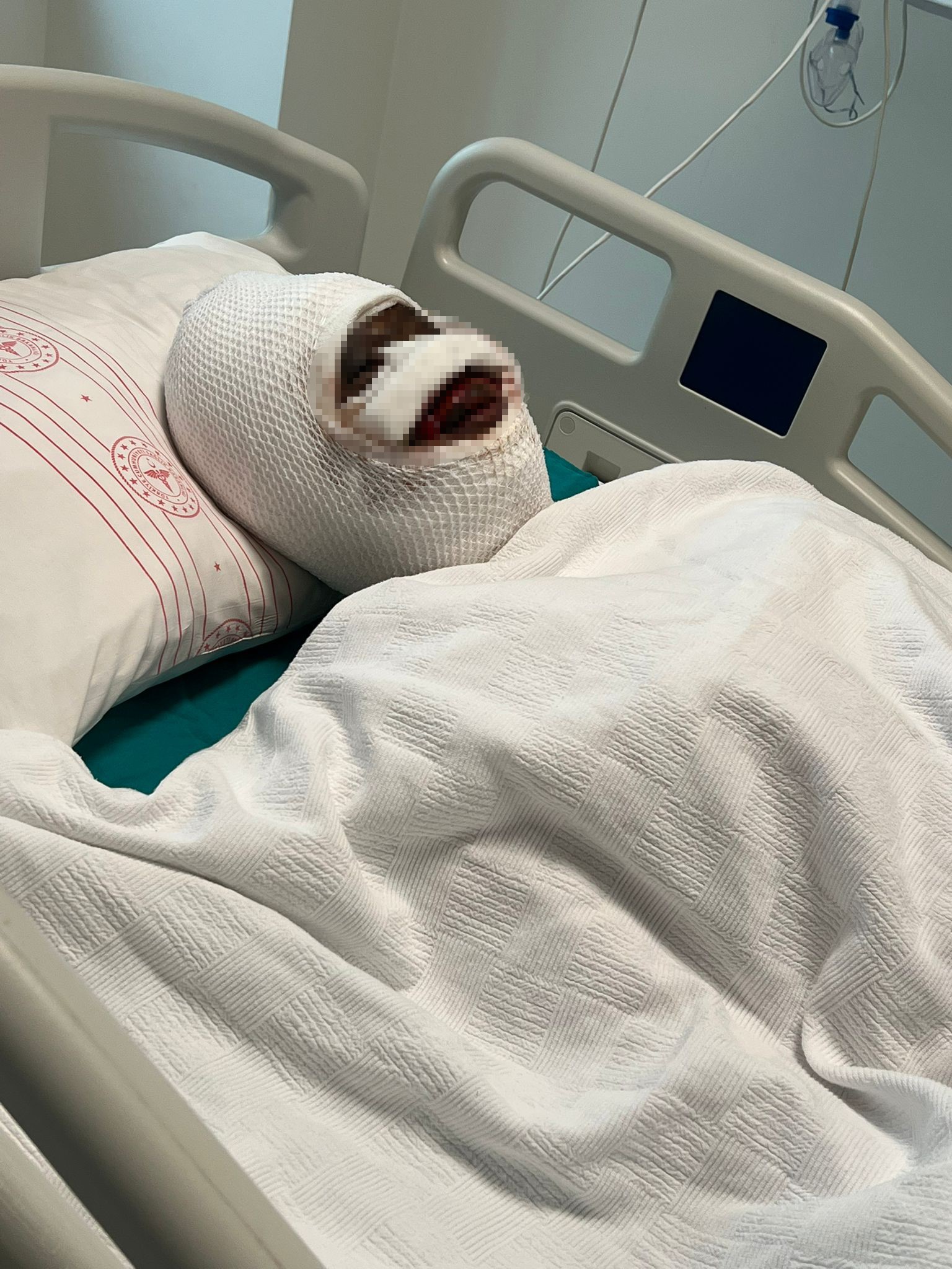 Eski Kocası Dehşeti Yaşattı! Evinde Bağladı, Asit Döktü, Kaçtı (2)