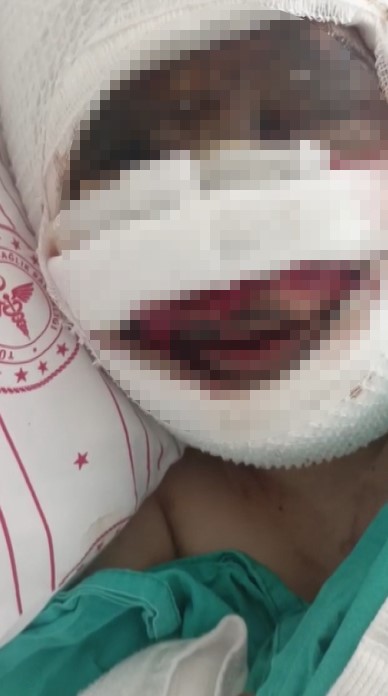 Eski Kocası Dehşeti Yaşattı! Evinde Bağladı, Asit Döktü, Kaçtı (3)