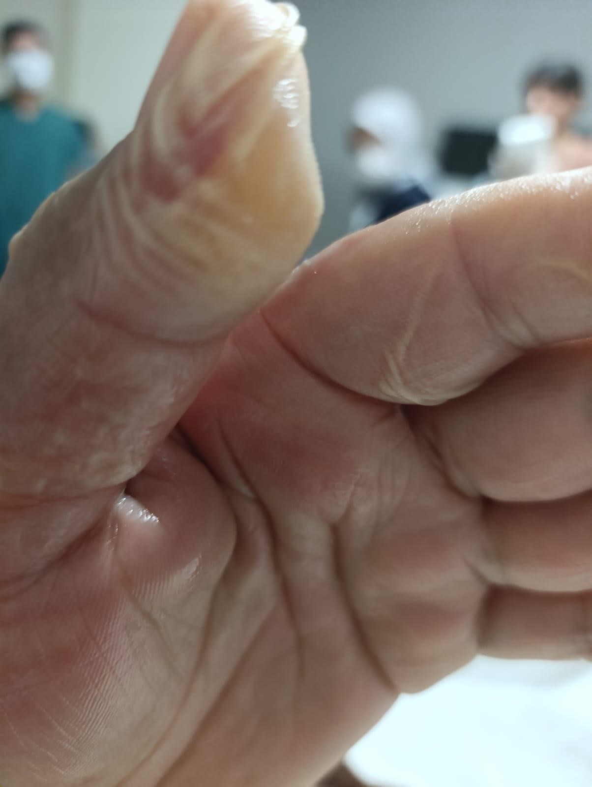 Her Evde Var Zararsiz Saniliyor Vucudunun Yuzde 30U Yandi (3)