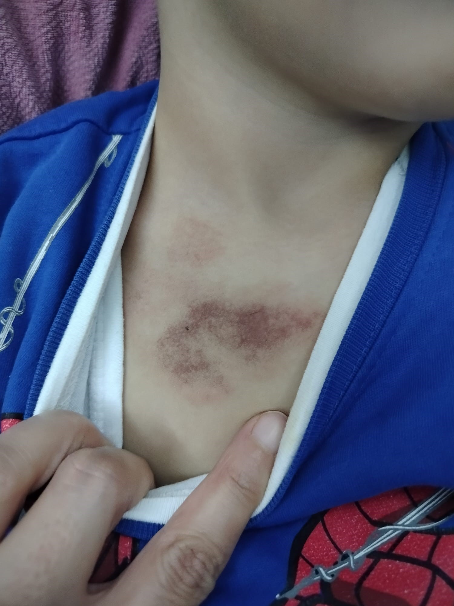 İbb Kreşinde Şok Iddia 3 Yaşındaki Çocuğa Şiddet Ve Istismar (3)