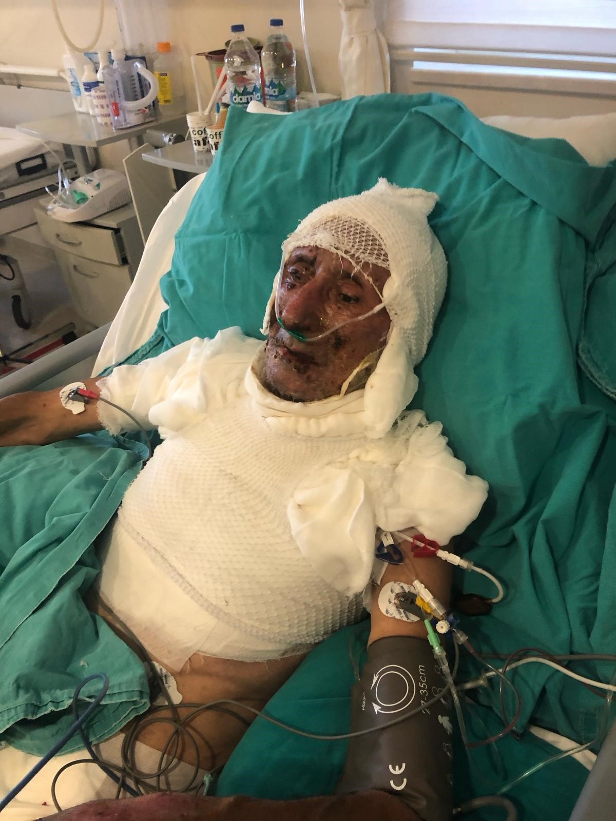 Iki Kardesin Miras Kavgasi Uzerime Benzin Dokup Cakmagi Cakti (3)