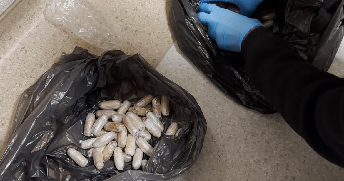 Midesini Zehir Deposuna Cevirmis Tam 64 Paket Tek Tek Icinden Cikardilar (2)