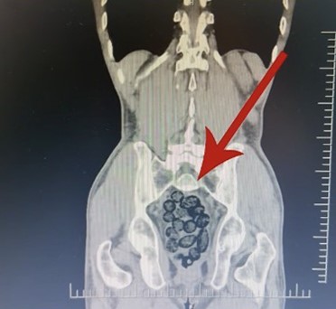 Midesini Zehir Deposuna Cevirmis Tam 64 Paket Tek Tek Icinden Cikardilar (3)