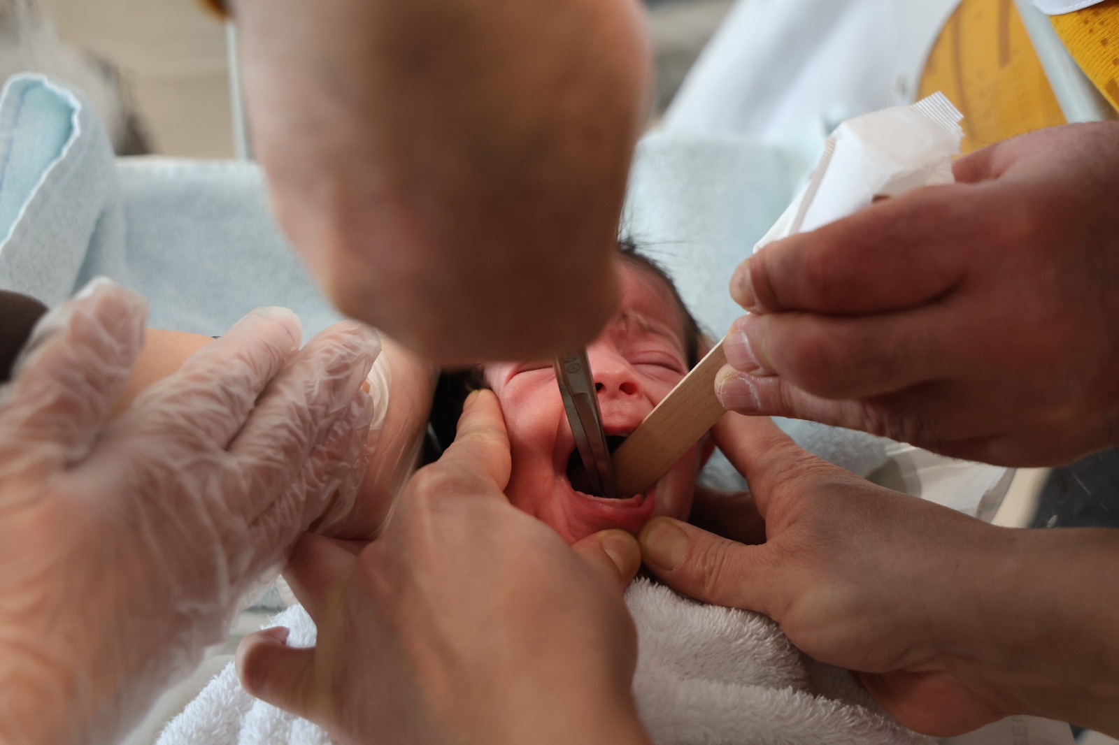 Minicik Bedeniyle 3 Saatlik Olum Kalim Savasi Ada Bebegin Inanilmaz Kurtulusu (4)