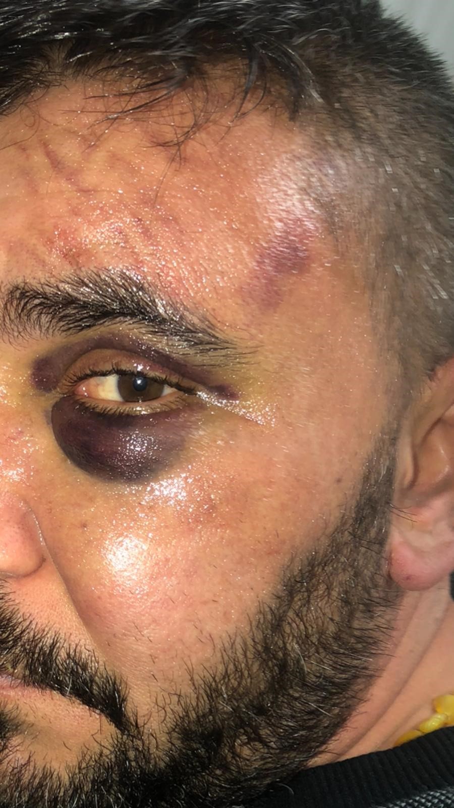 Restoranda Dehşet Anları Yumruk, Tekme, 3 Dakikalık Öldüresiye Dayak (2)