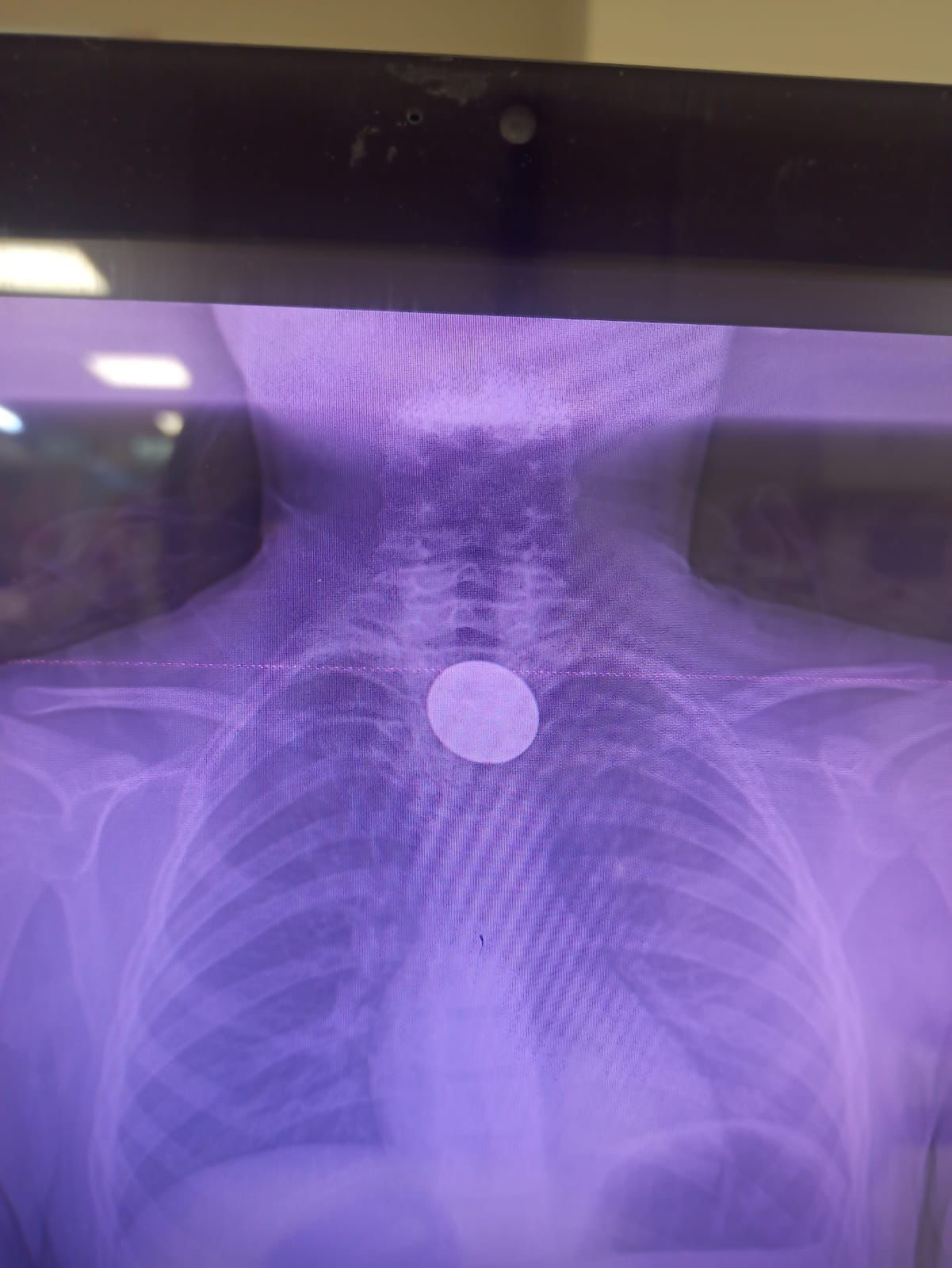 Saniyelerle Yarisildi Kucuk Cocuk Olumden Dondu (3)