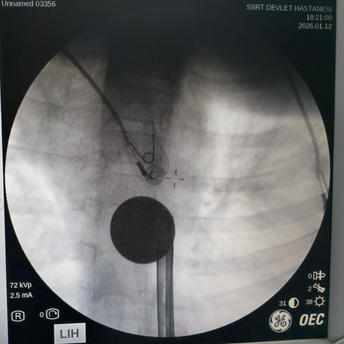Saniyelerle Yarisildi Kucuk Cocuk Olumden Dondu (4)