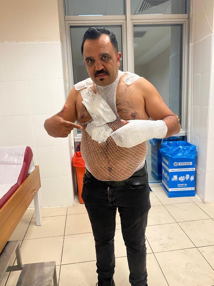 Sosyal Medya Deneyi Facia Ile Bitti Tostcu Rasit Kendini Yakti (2)