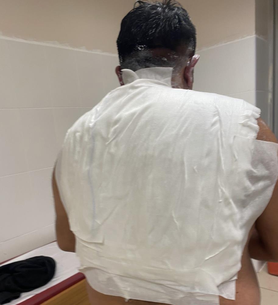 Sosyal Medya Deneyi Facia Ile Bitti Tostcu Rasit Kendini Yakti (3)