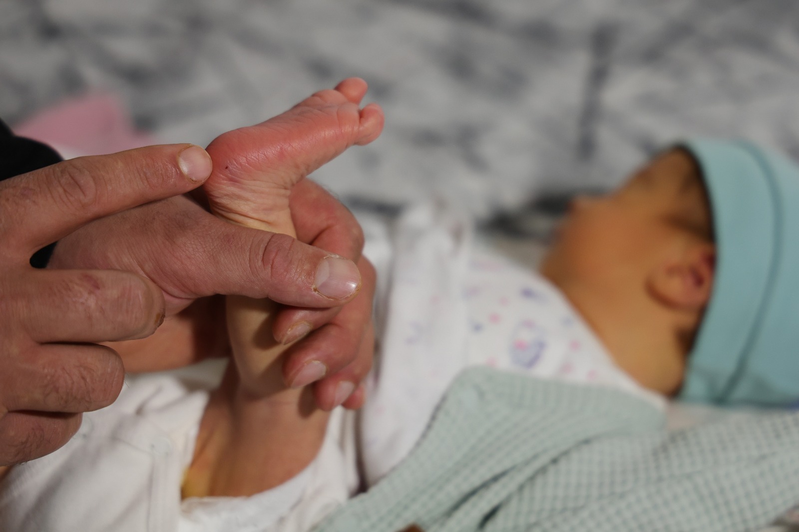 Topuk Kani Krizi Buyuyor Aile Bebeklerine Kayyum Atanmasindan Korkuyor (1)-2