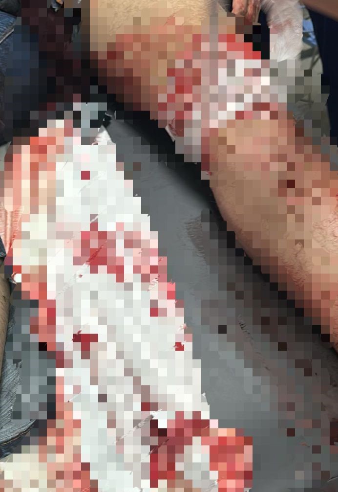 Trafik Cezası Yüzünden Buluştular, Kavga Kanlı Bitti (2)