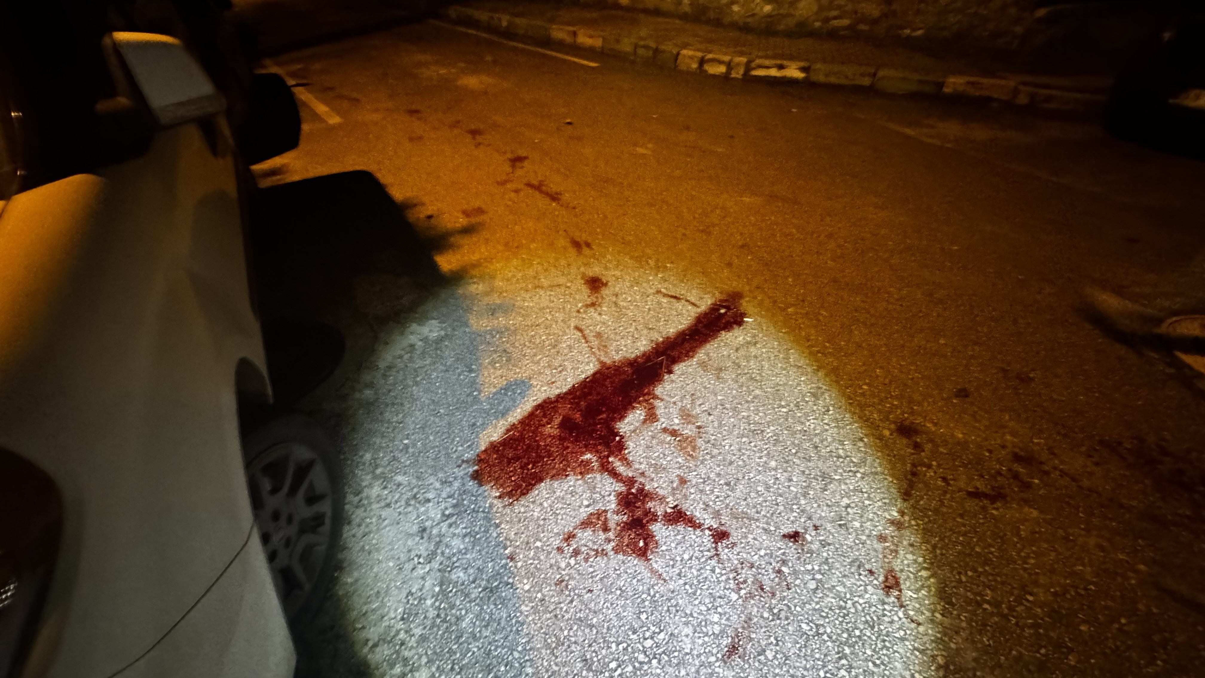 Trafik Cezası Yüzünden Buluştular, Kavga Kanlı Bitti (3)