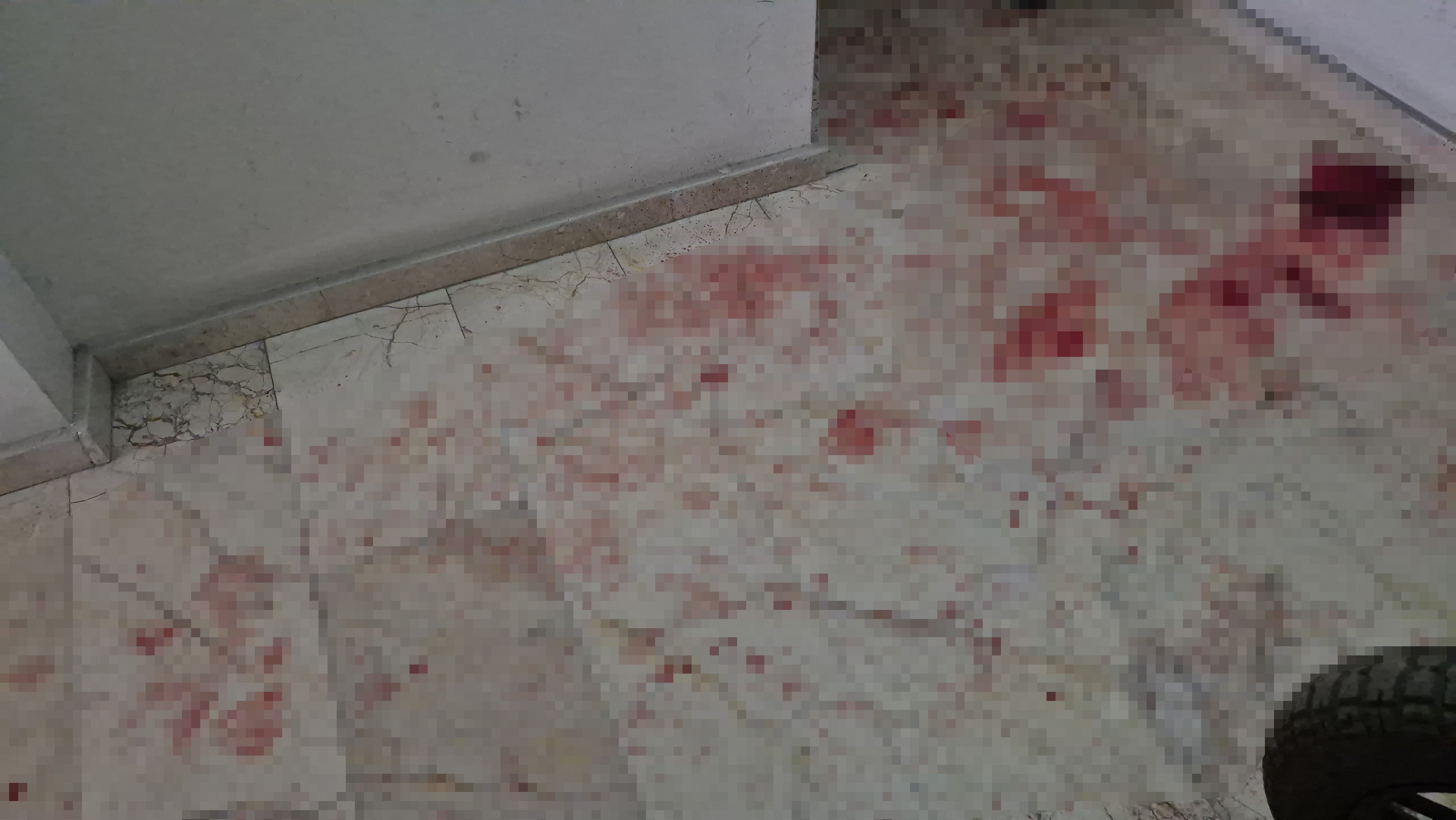 Uvey Ogul Dehseti Bicaklanan Adam Yasam Savasini Kaybetti (4)