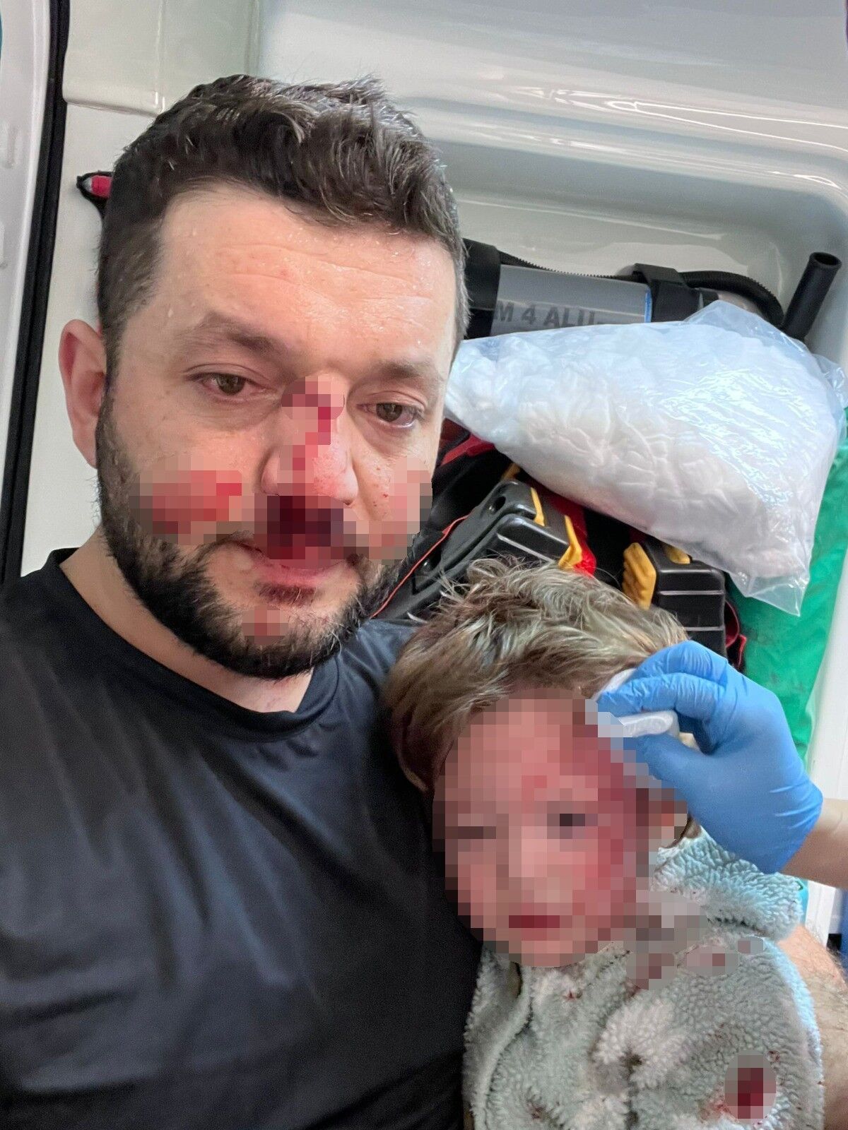 14 Aylik Bebek Ve Babasina Saldiri Sosyal Medyada Fotografim Fail Gibi Paylasildi Cocu (3)