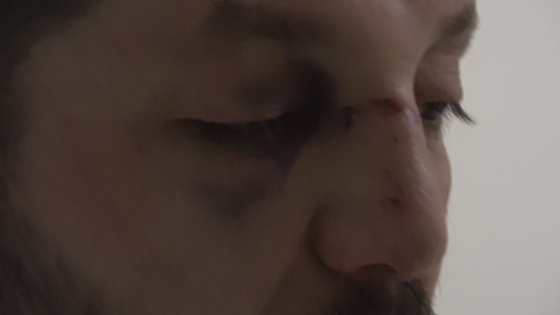 Gürültü Kavgası Vahşete Dönüştü! Bebeğin Kafatası Çatladı, Babanın Burnu Kırıldı (5)