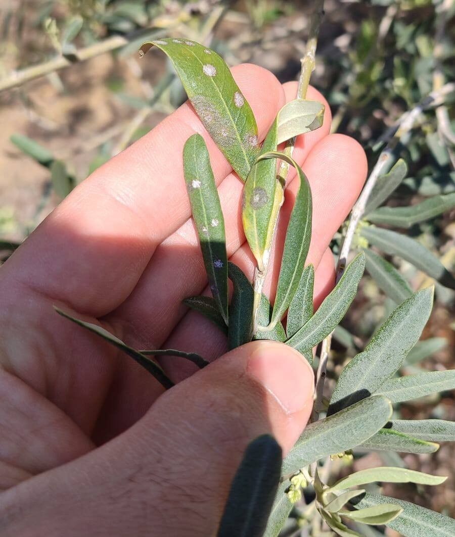 Halkali Leke Hastaligi Alarmi Halkali Leke Hastaligi Riskinde Artis Ilaclama Zamani Ge (2)