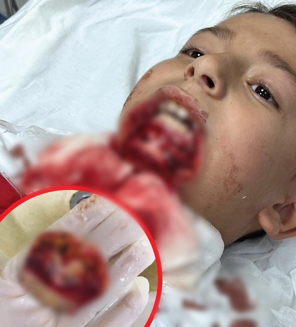 Okul Faciasinda Bilirkisi Raporu Ihmaller Zinciri Tek Tek Aciklandi (4)