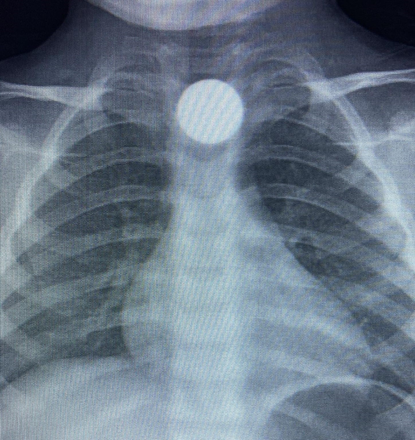 Yerden Aldi Agzina Atti Evdeki Tehlike Canindan Ediyordu (2)