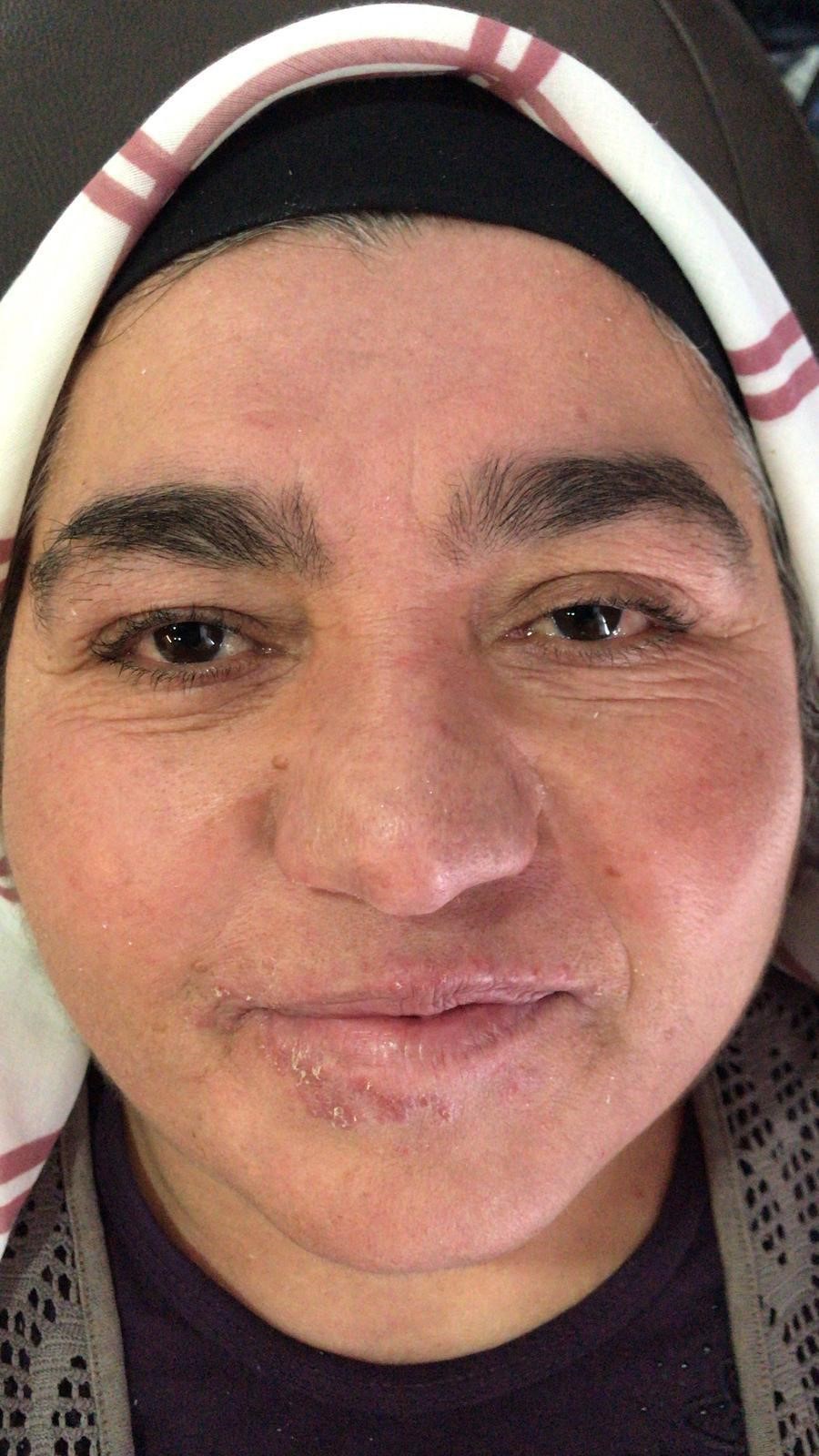 Yıllarca Saklandı, Sessiz Çilesi Sona Erdi! Aylar Süren Tedaviyle Hayata Döndü (2)