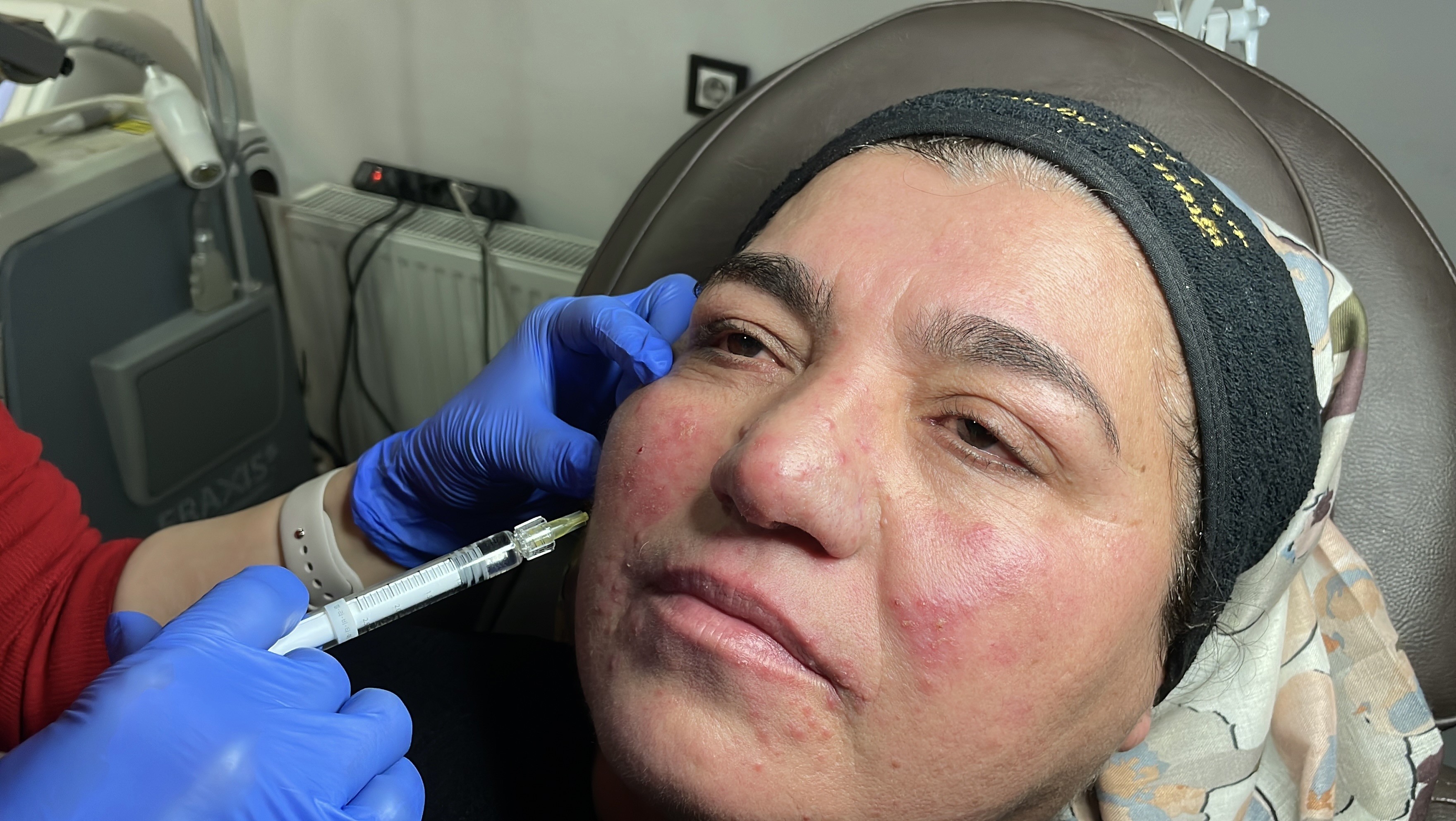 Yıllarca Saklandı, Sessiz Çilesi Sona Erdi! Aylar Süren Tedaviyle Hayata Döndü (5)