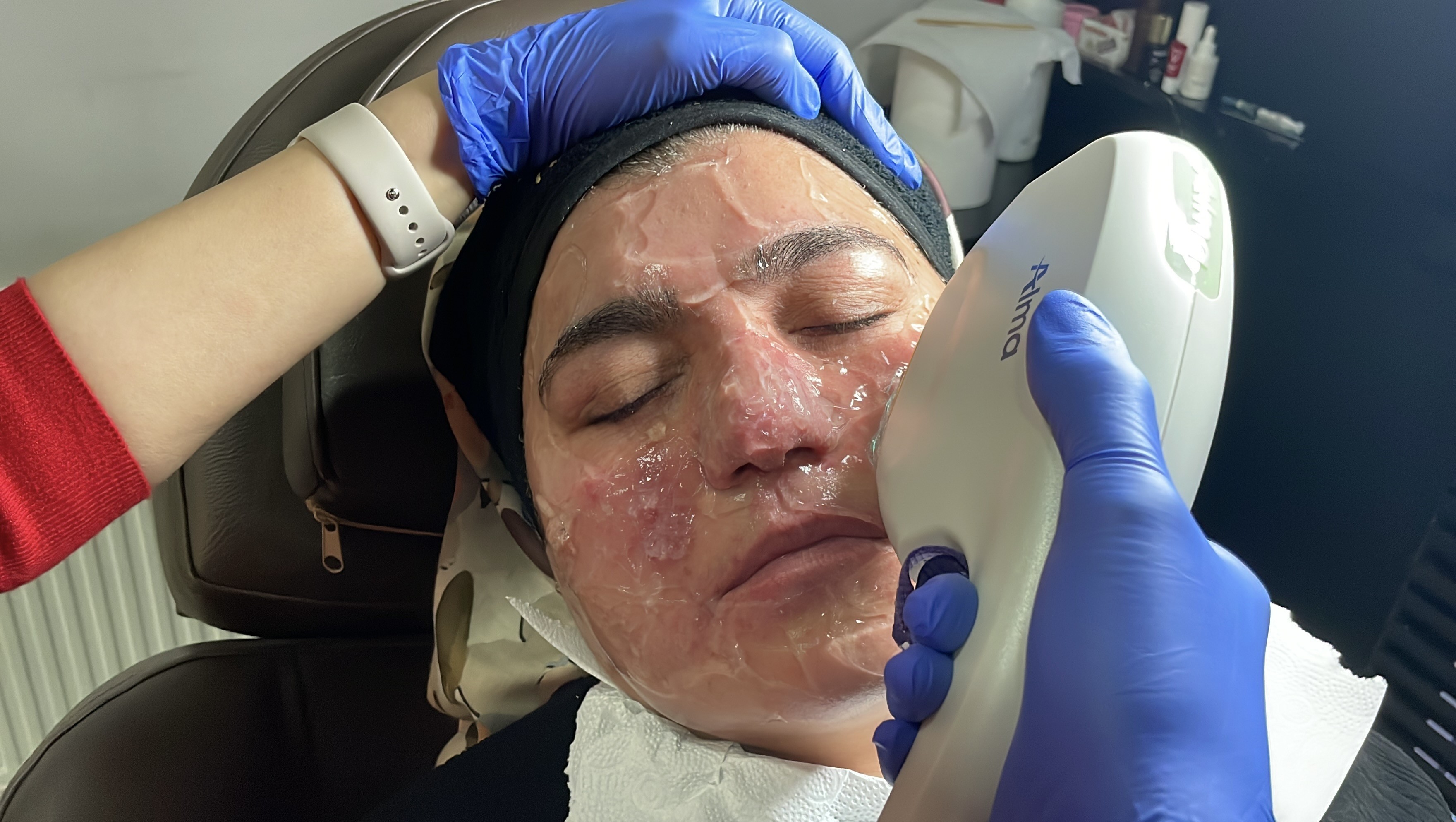 Yıllarca Saklandı, Sessiz Çilesi Sona Erdi! Aylar Süren Tedaviyle Hayata Döndü (7)