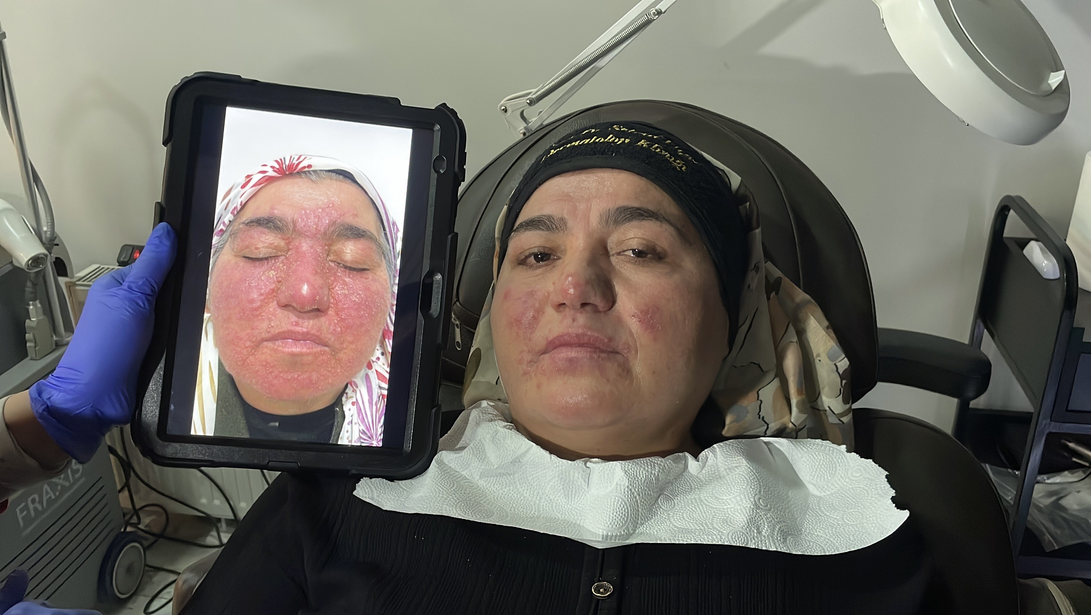 Yıllarca Saklandı, Sessiz Çilesi Sona Erdi! Aylar Süren Tedaviyle Hayata Döndü (9)