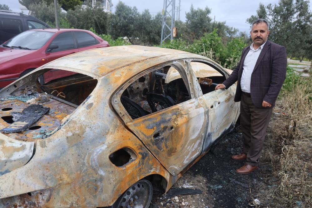 Evin Onunde Park Halindeydi Benzin Doktu Araci Yakti Kacarken Kendisi De Yandi (4)