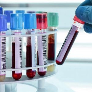 Kan Alma Tüpleri (1)