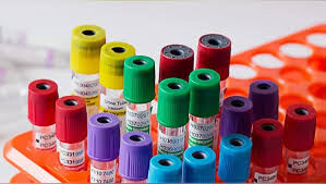 Kan Alma Tüpleri (2)