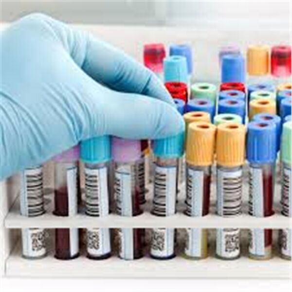 Kan Alma Tüpleri (4)