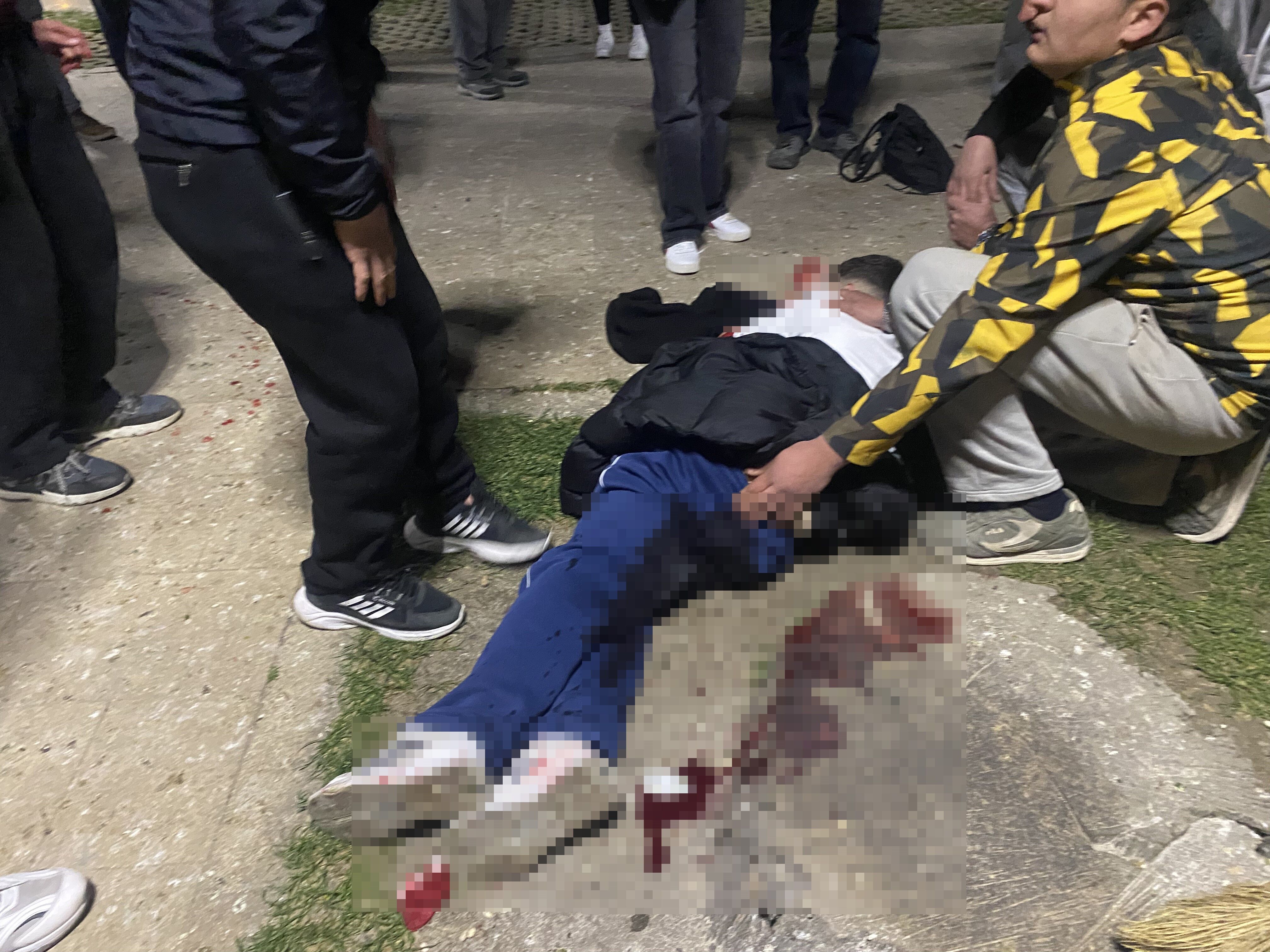 Parkta Gece Yarisi Dehset 16 Yasindaki Cocuk Bicaklandi Yakinlari Sinir Krizi Gecirdi (3)