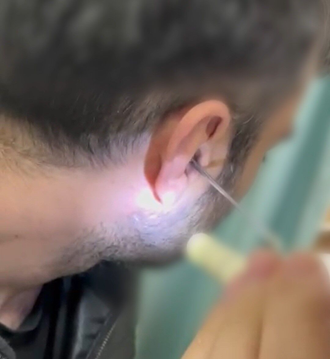 Polis Durdurdu Gercek Hastanede Ortaya Cikti Uyusturucu Kulaktan Cikti (2)