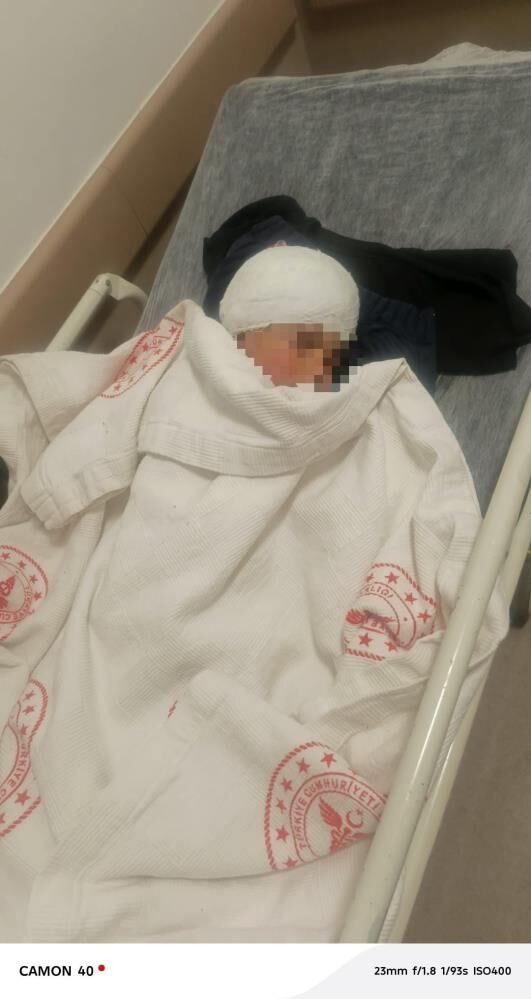 Sokakta Oyun Oynuyordu Biranda Hayati Karardi 3 Yasindaki Cocuk 12 Gunde 3 Ameliyat Ge (5)