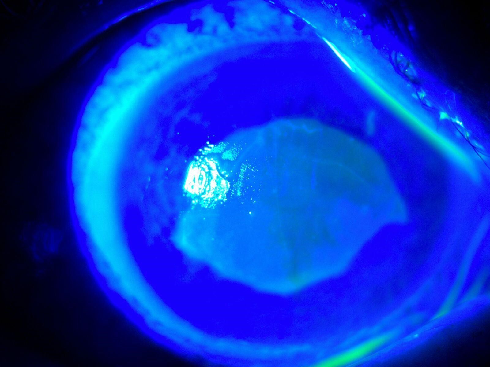 52 Yasindaki Kadin Buldugu Yontemi Gozlerine Damlatinca Gorme Yetisini Kaybetti (2)