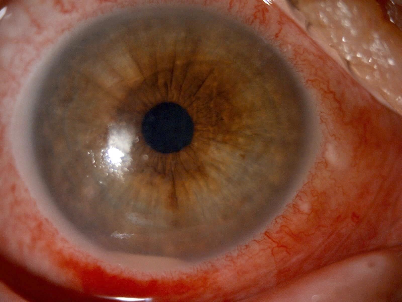 52 Yasindaki Kadin Buldugu Yontemi Gozlerine Damlatinca Gorme Yetisini Kaybetti (4)