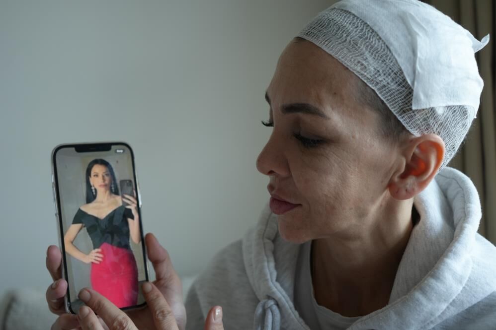 Anne Ve Oglunu Darp Eden Suphelilerden Merdivenden Dustu Savunmasi (2)