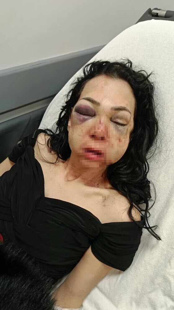 Anne Ve Oglunu Darp Eden Suphelilerden Merdivenden Dustu Savunmasi (4)