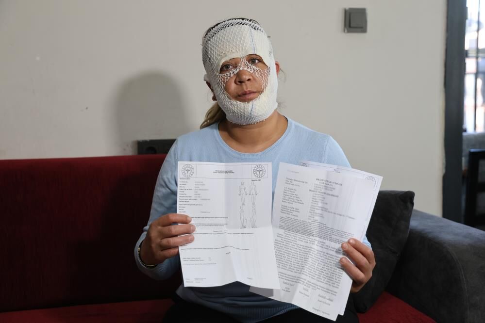 Guzellesmek Icin Gitti Yaniklarla Dondu 2 Yasindaki Oglu Annesinden Korktu (3)