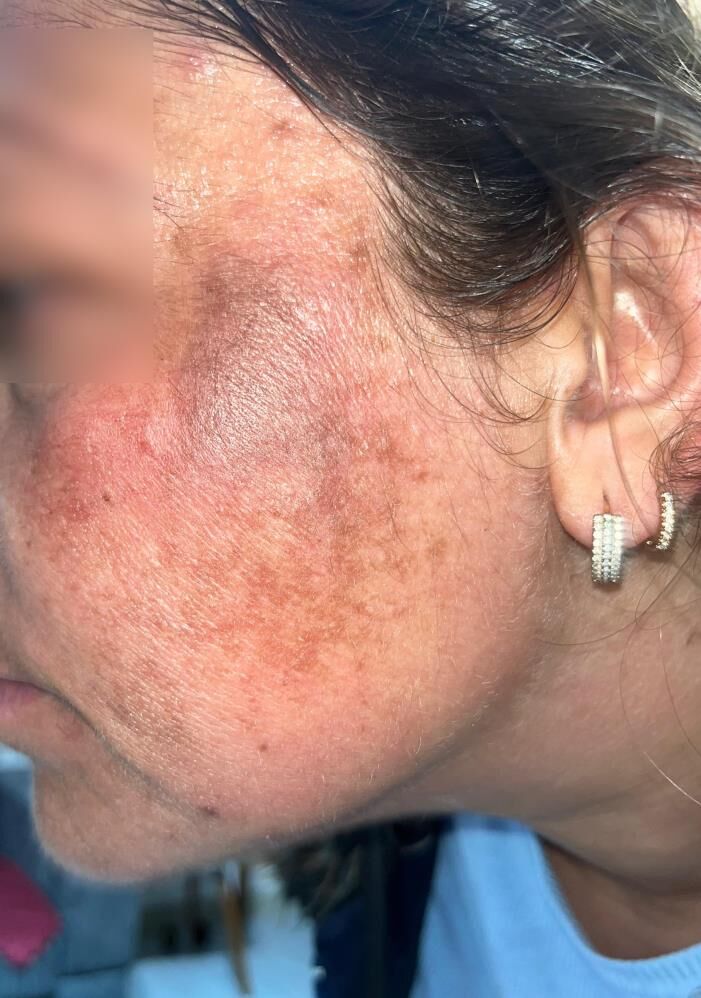 Guzellesmek Icin Gitti Yaniklarla Dondu 2 Yasindaki Oglu Annesinden Korktu (4)