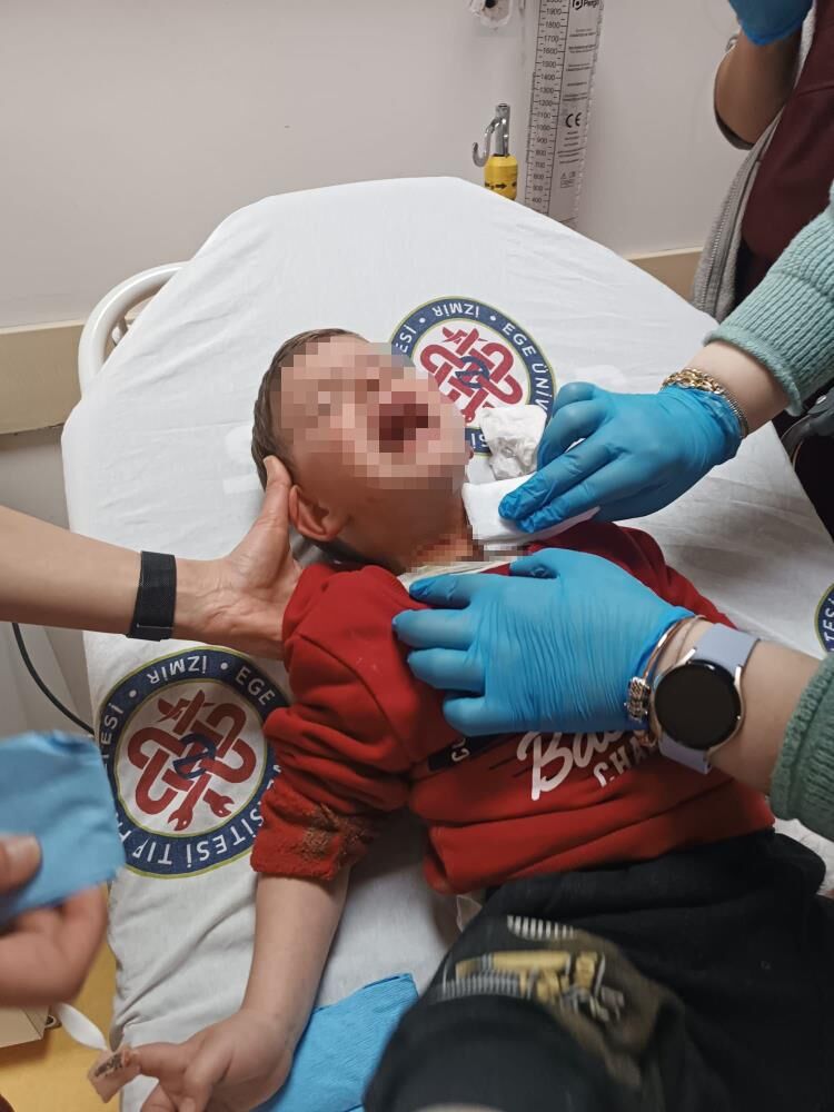 Parkta Oynayan 2 Yasindaki Cocuga Bicakli Saldiri Kacan Supheli Evinde Yakalandi (2)